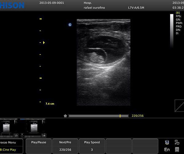 Artigos - Módulo 3: texto 2 - Ultrassonografia: diagnóstico precoce de gestação
